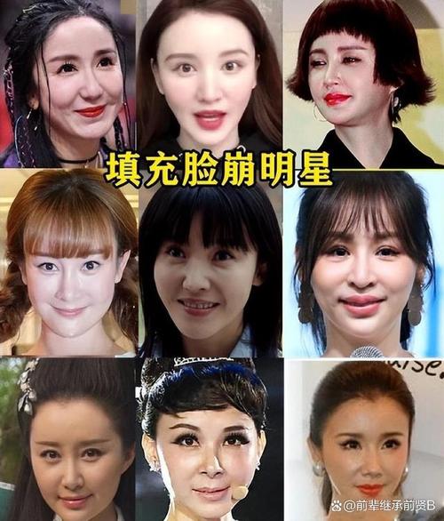 娱乐圈整容泛滥：明星的脸越来越假，你还追吗？