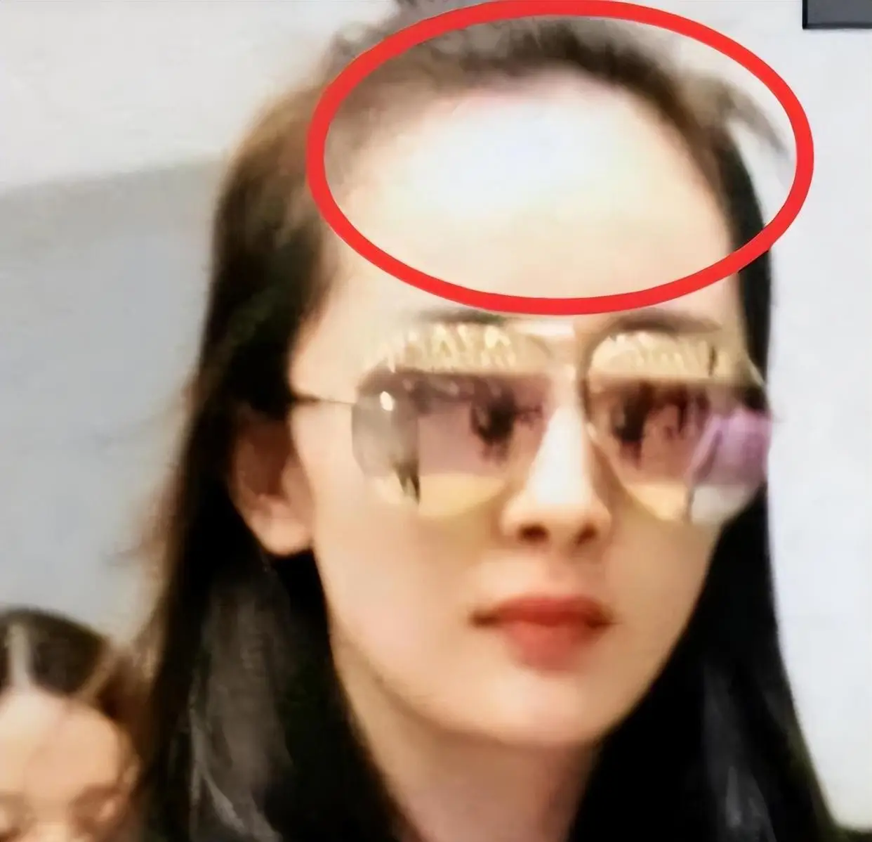 杨幂赵丽颖金晨假发片_女明星脱发严重_发量少的女明星有哪些